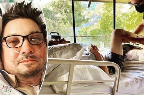 did jeremy renner lose his leg|Jeremy Renner Broke 30 Bones in Snowplow Accident, Posts。